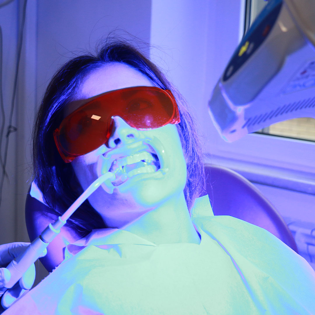 SBIANCAMENTO DENTALE PROFESSIONALE - Studio Dentistico del Dr. Filippo Maria De Luca - Mozzagrogna, Abruzzo