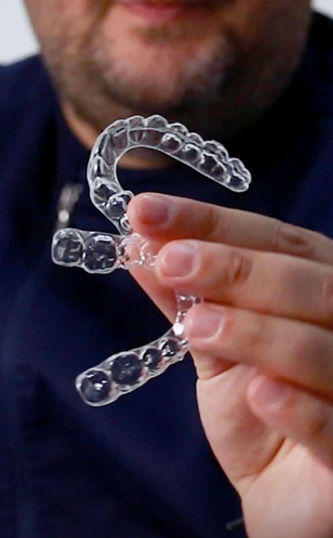 I vantaggi degli allineatori dentali invisibili per un sorriso perfetto: la tua soluzione estetica e confortevole! Gli allineatori dentali invisibili dal Dr. Filippo Maria De Luca Allineatori dentali trasparenti Studio dentistico Dr. Filippo Maria De Luca