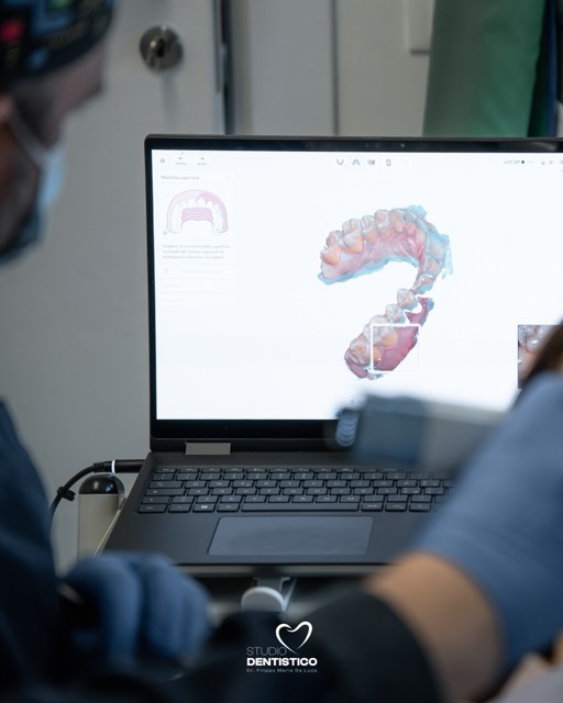 Odontoiatria digitale, implantologia e check-up odontoiatrico nello Studio Dentistico del Dr. Filippo Maria De Luca a Mozzagrogna, vicino Lanciano (CH), con diagnosi digitale e percorsi di cura personalizzati.