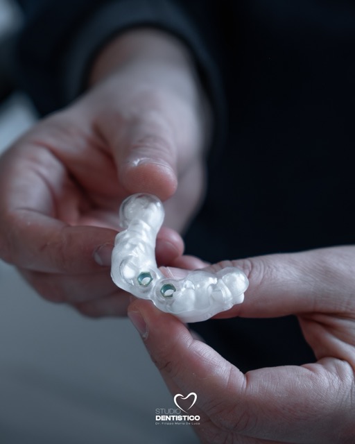 Odontoiatria digitale, implantologia e check-up odontoiatrico nello Studio Dentistico del Dr. Filippo Maria De Luca a Mozzagrogna, vicino Lanciano (CH), con diagnosi digitale e percorsi di cura personalizzati.